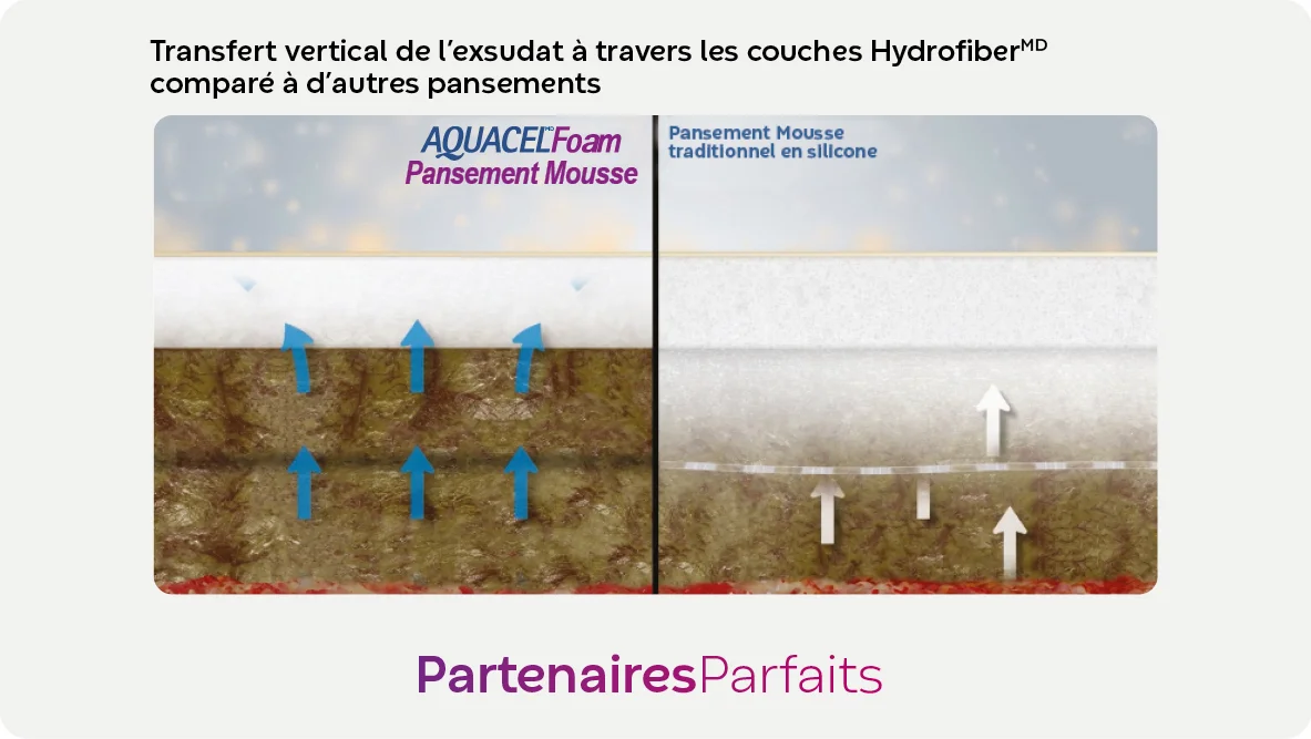 Comparaison du transfert vertical de l'exsudat à travers les couches d'Hydrofiber dans les pansements Extra, Foam et un pansement traditionnel en mousse de silicone.